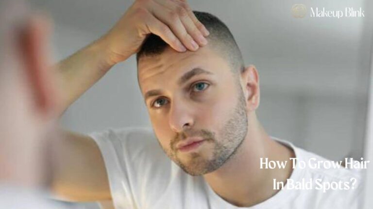 How To Grow Hair In Bald Spots